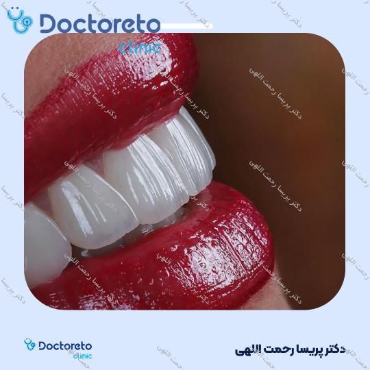 جرم گیری دو فک با بروساژ زیر لثه