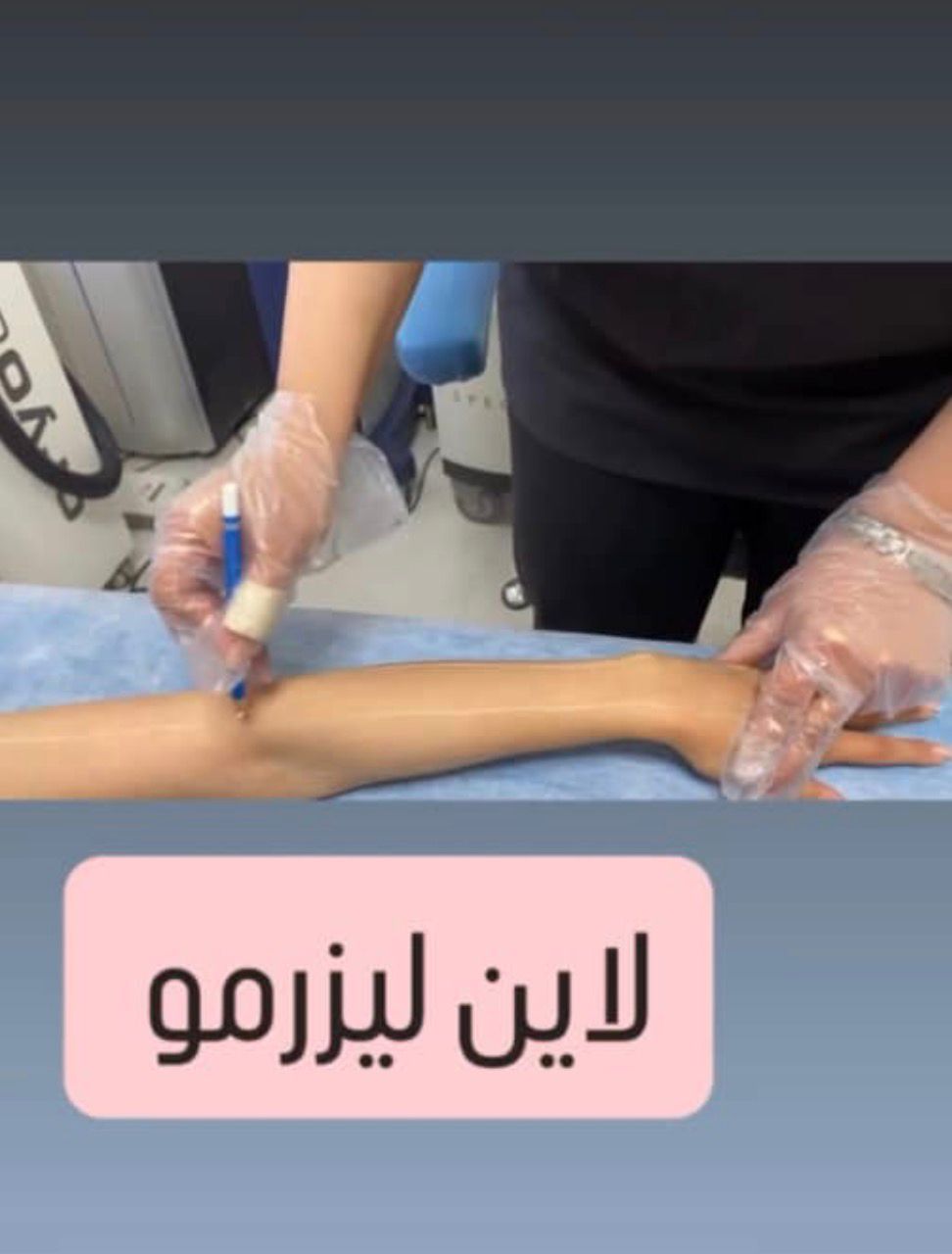 لیزر موهای زائد بانوان و آقایان با دستگاه کلاریتی⚡