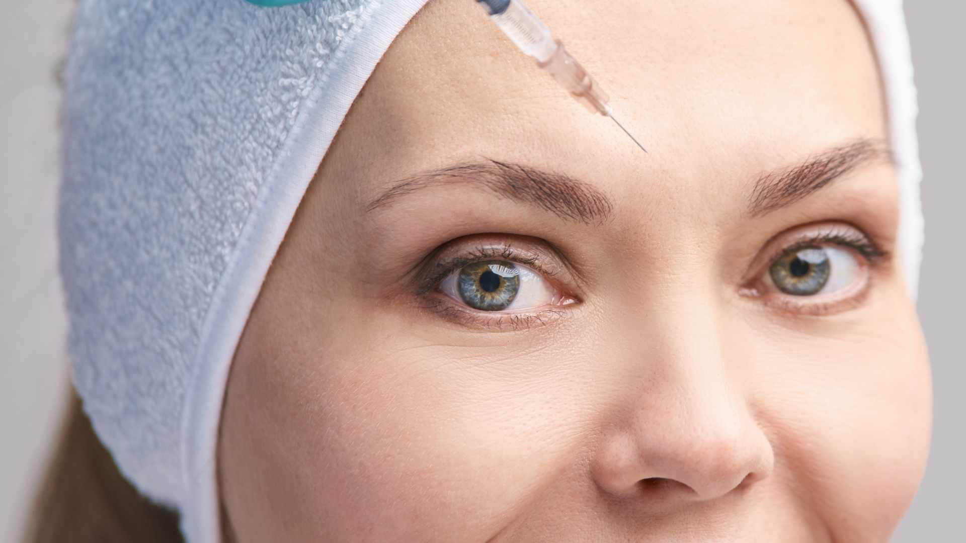 تزریق بوتاکس صورت (پیشانی، خط اخم، پنجه کلاغی)