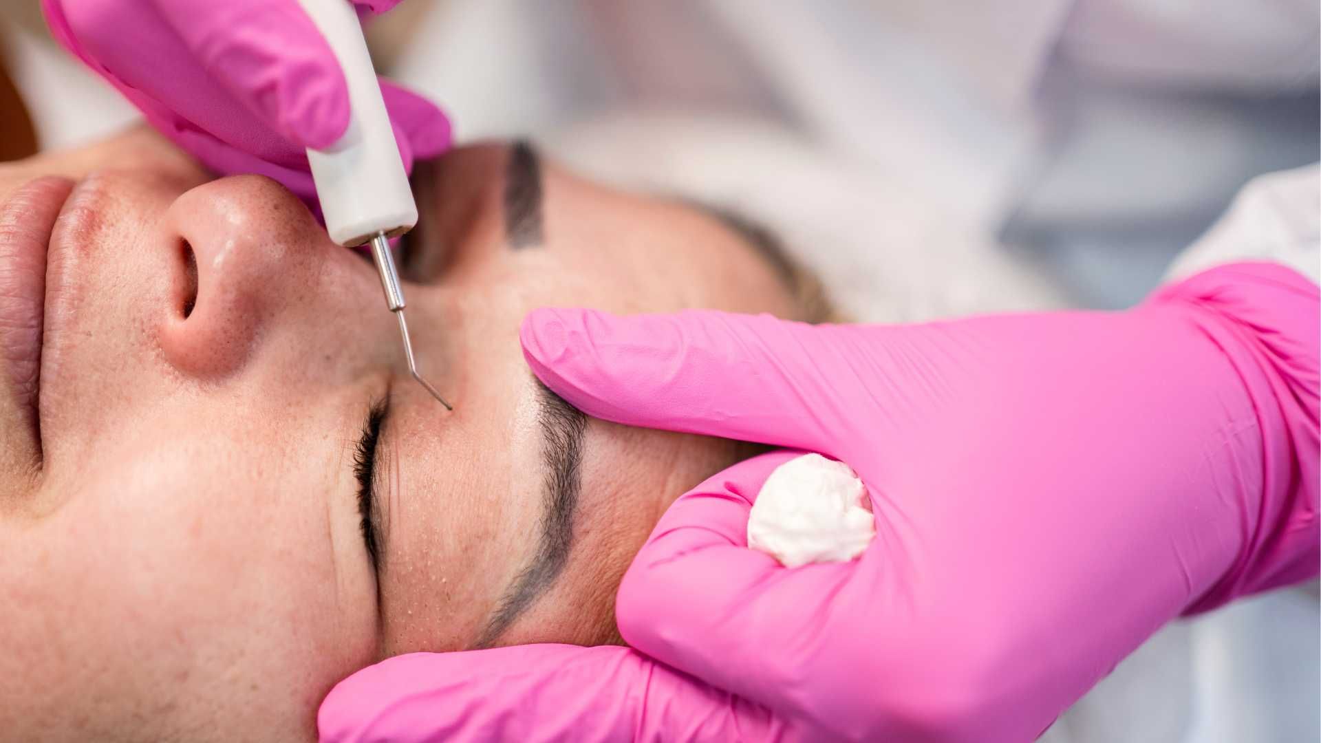 بلفاروپلاستی به روش جراحی