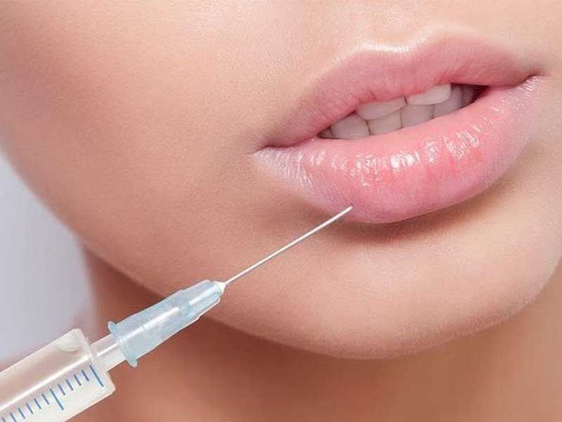 تزریق ژل لب
