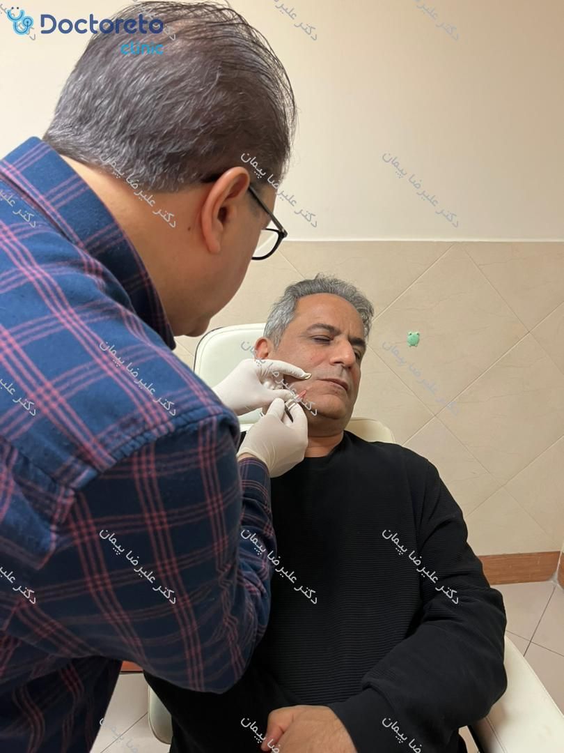 جوانسازی صورت با مزوژل