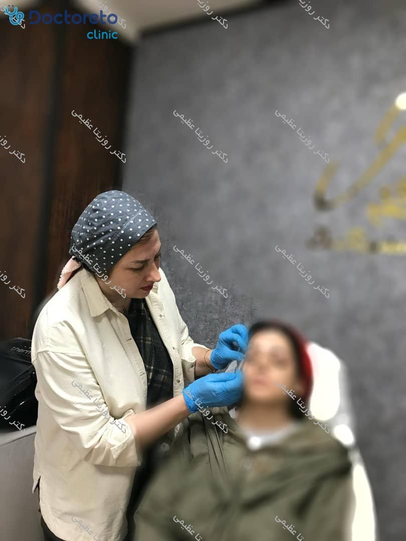تزریق بوتاکس صورت (پیشانی، خط اخم، پنجه کلاغی)💉