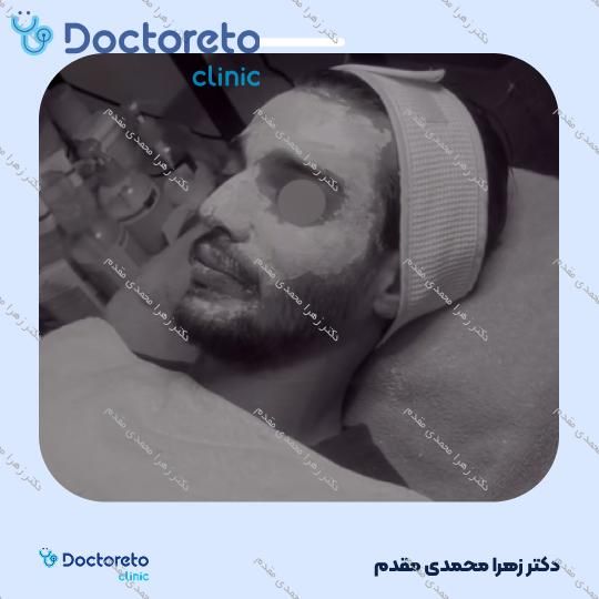 فیشیال (پاکسازی) صورت با روش VIP یا کلاسیک