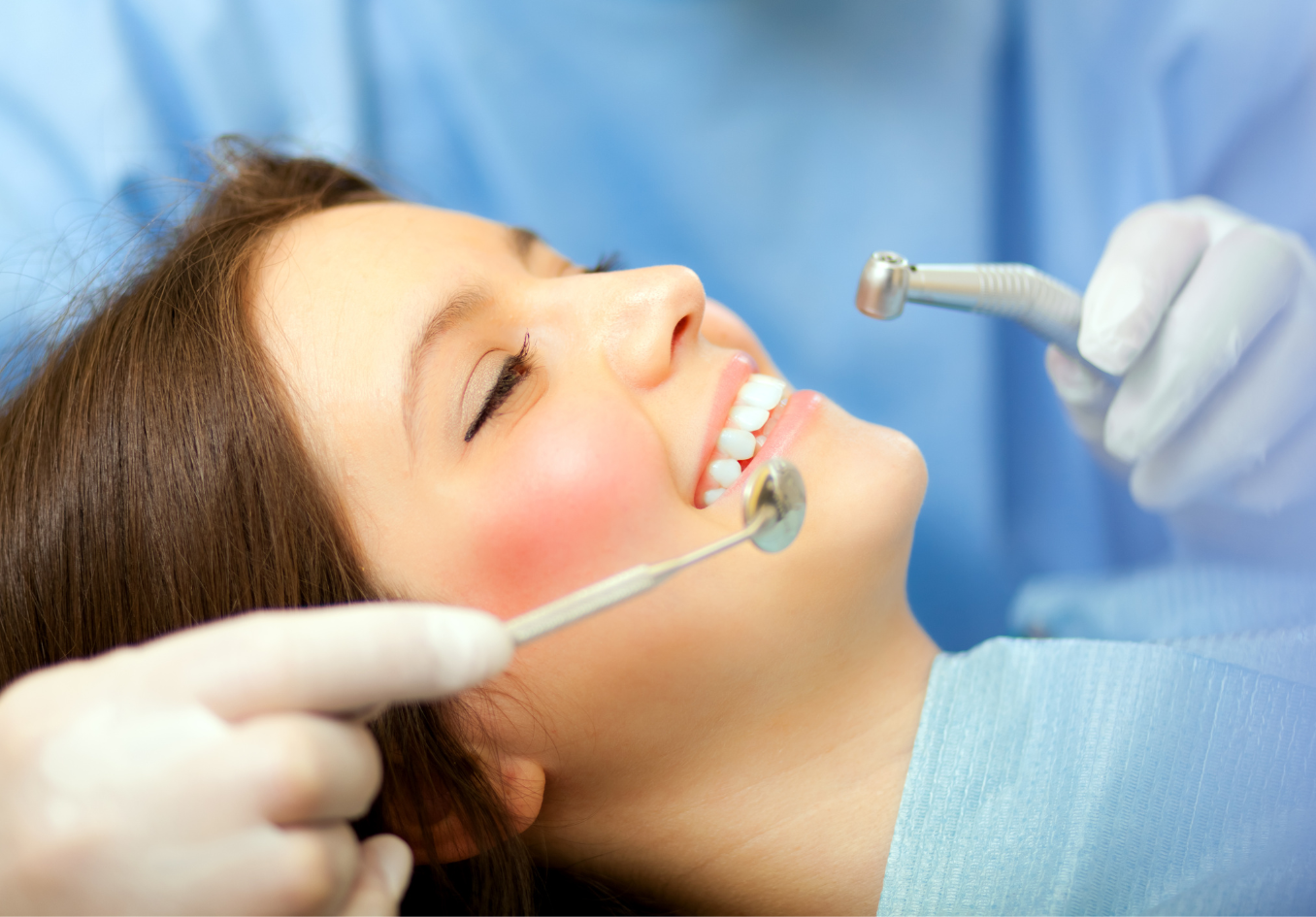 جرم گیری کامل دندان‌های دو فک با بروساژ🦷