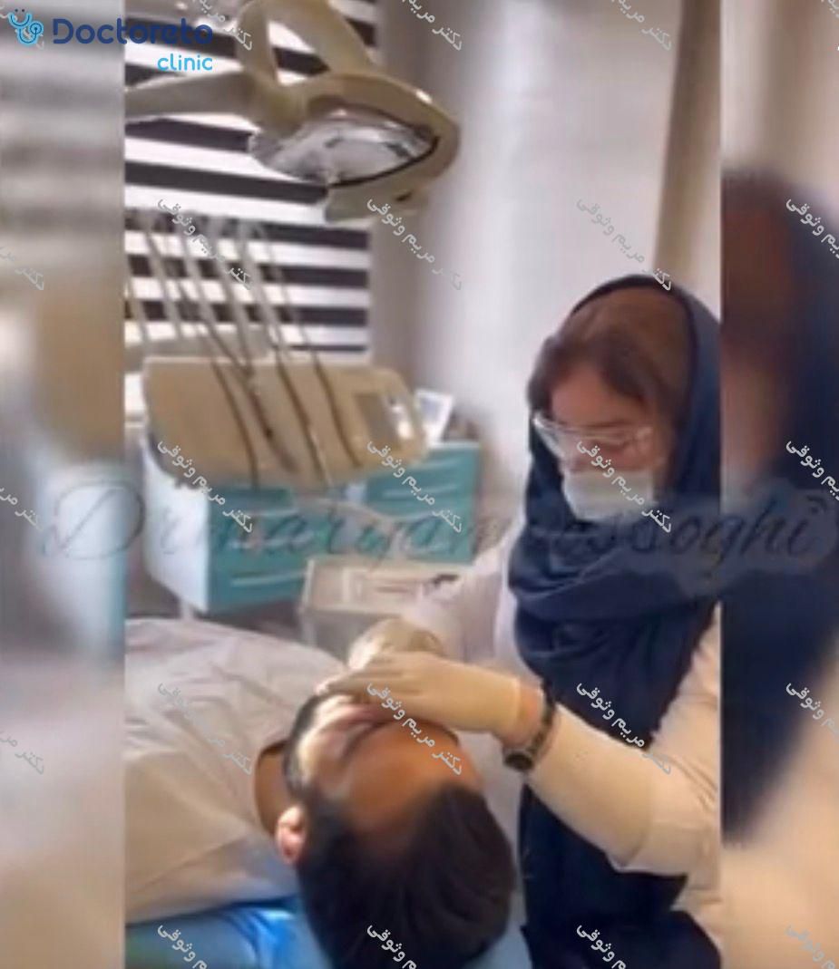 جرم گیری کامل دندان‌های دو فک با بروساژ🦷