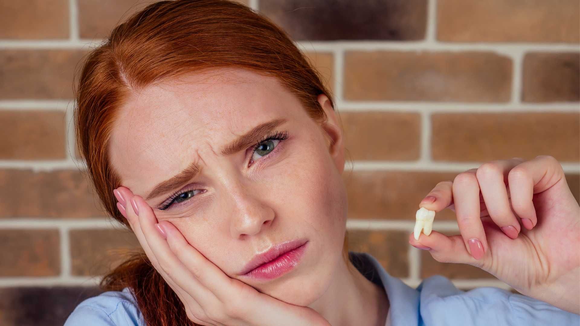 کشیدن دندان عقل