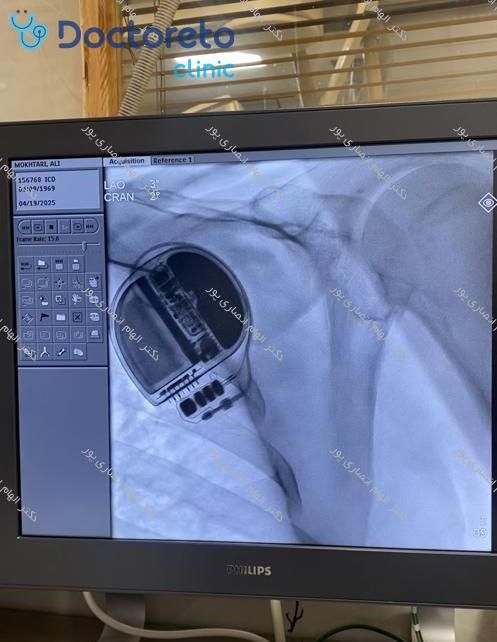 تنظیم باطری قلبی