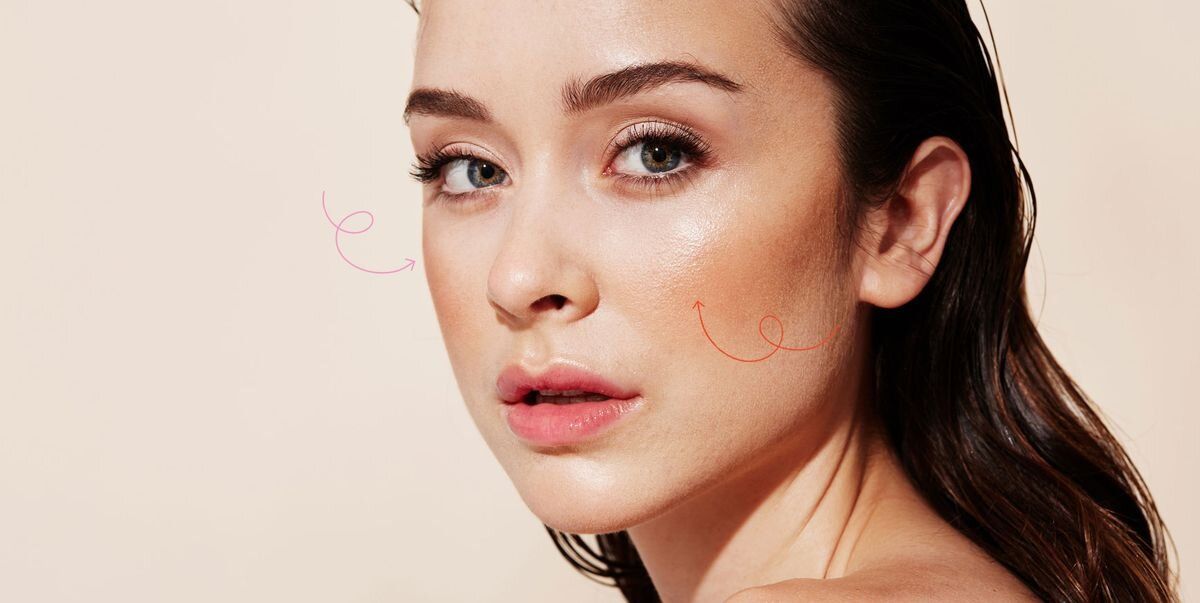 تزریق ژل گونه