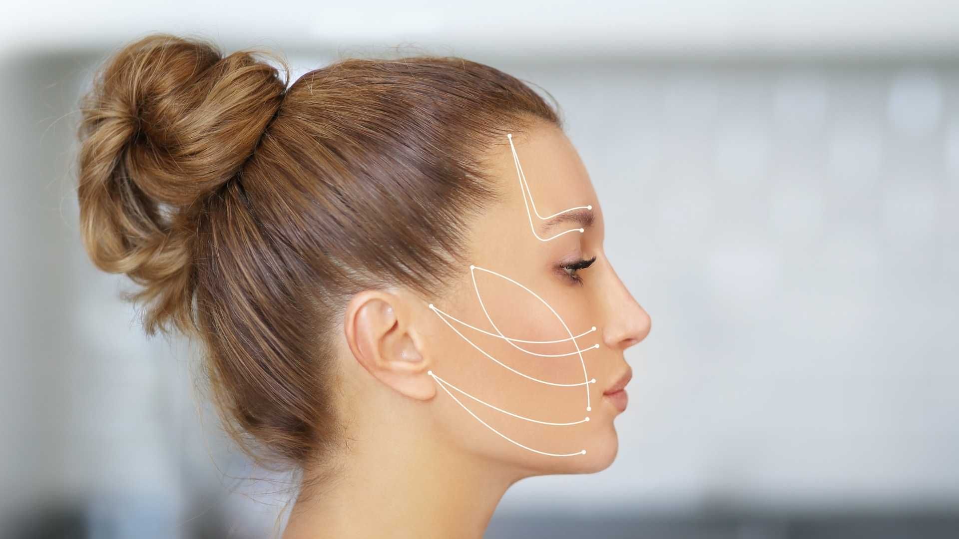 لیفت صورت با نخ (هر عدد)