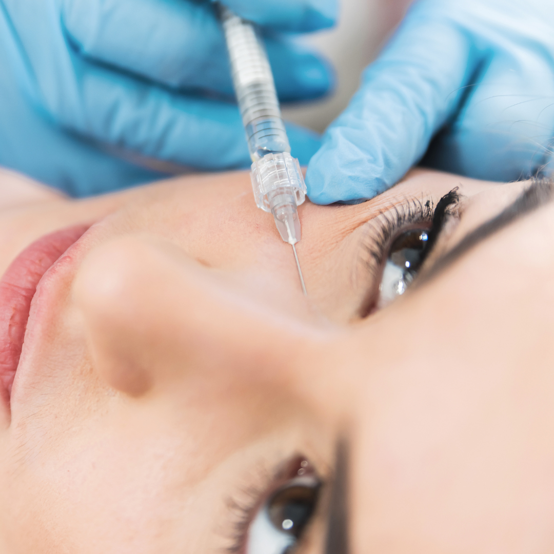 تزریق ژل زیر چشم