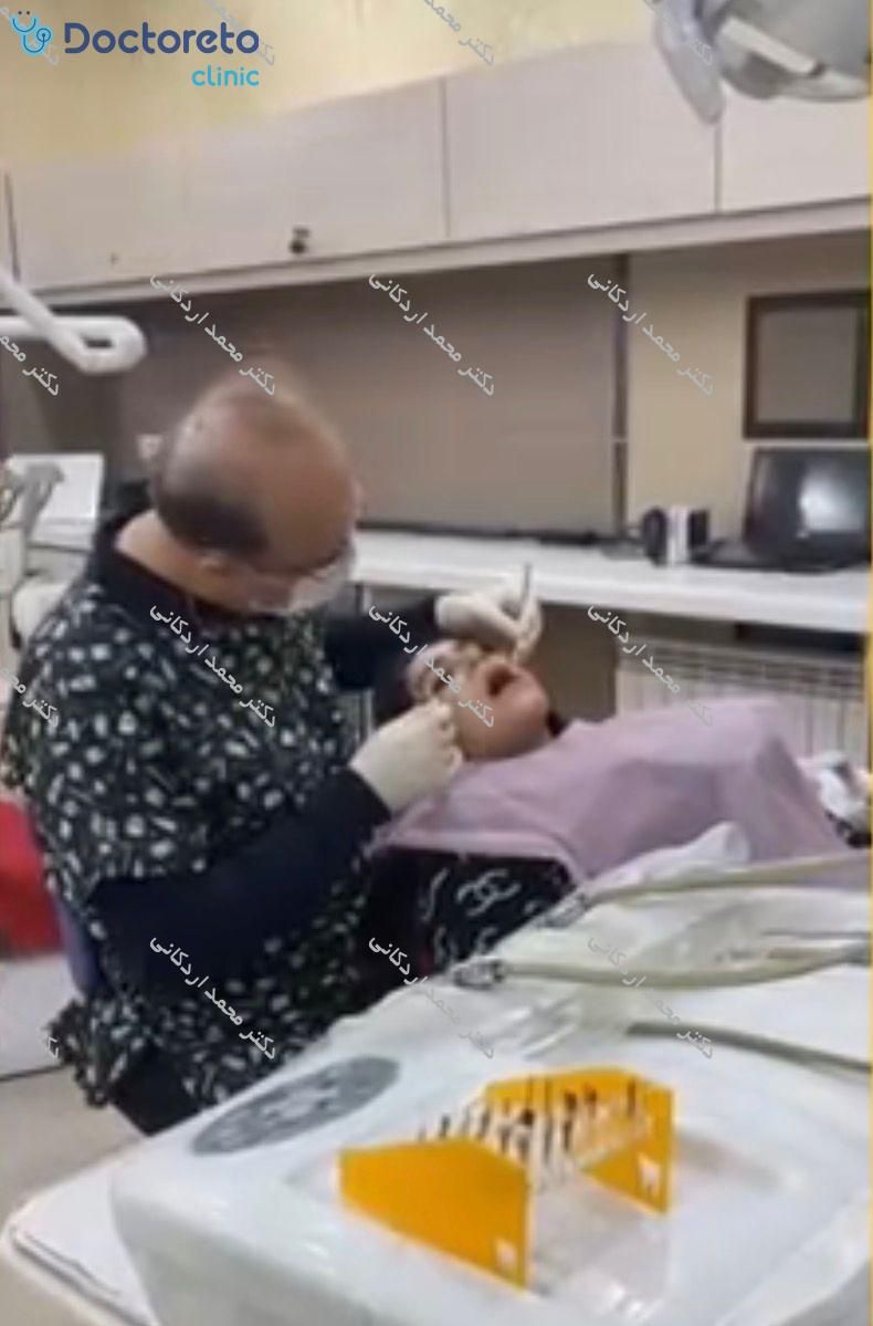 جرم گیری کامل دندان‌های دو فک با بروساژ🦷