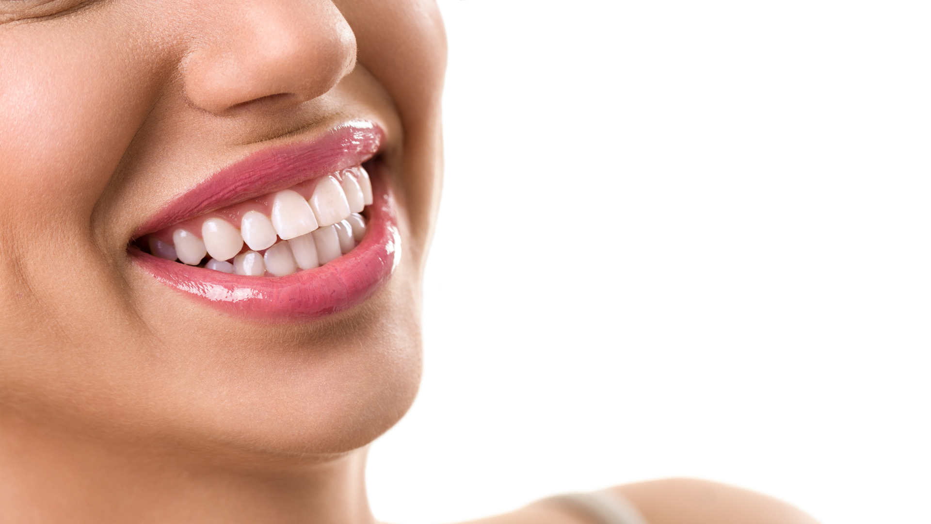 لمینت دندان (هر واحد)