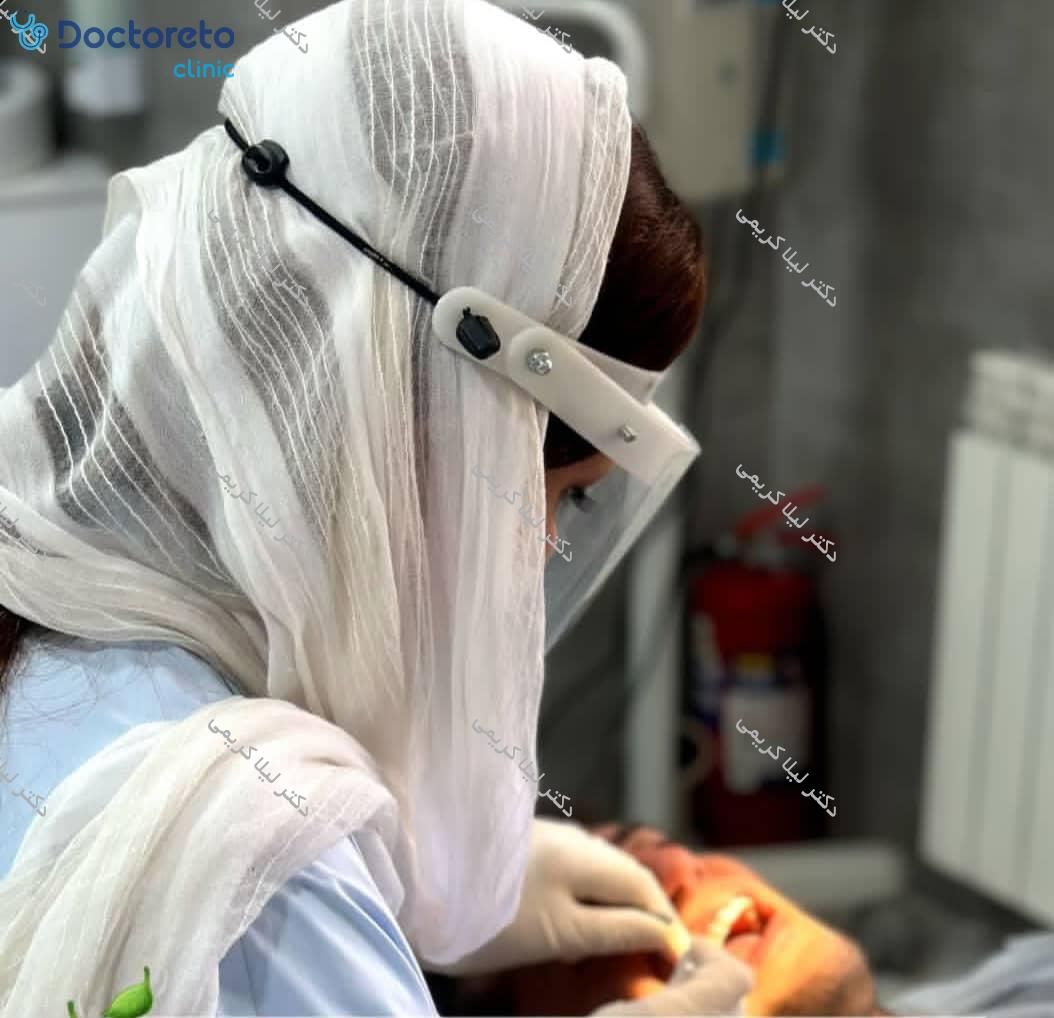 جرم گیری کامل دندان‌های دو فک با بروساژ🦷