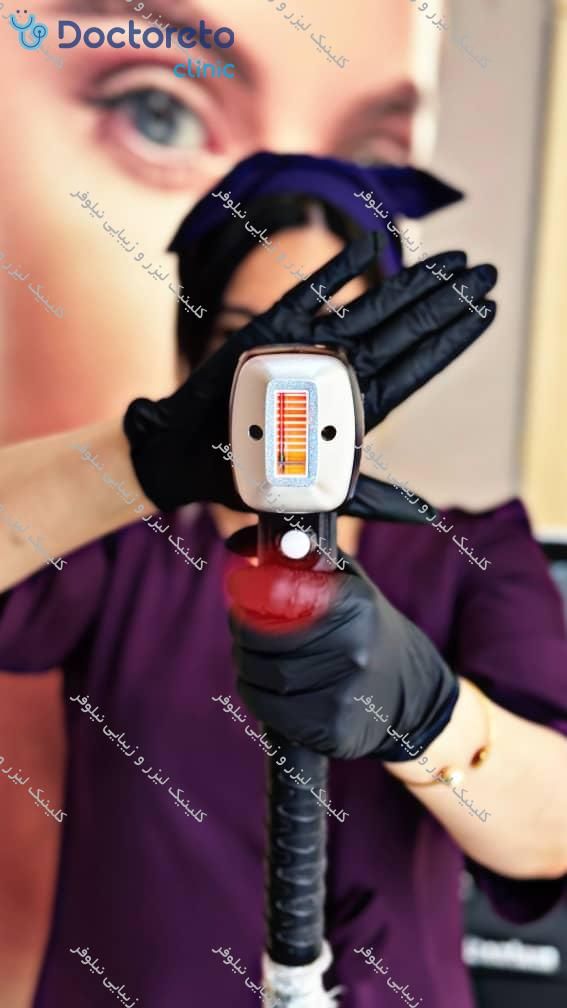لیزر موهای زائد بانوان و آقایان با دستگاه سوپرانو آیس تیتانیوم⚡