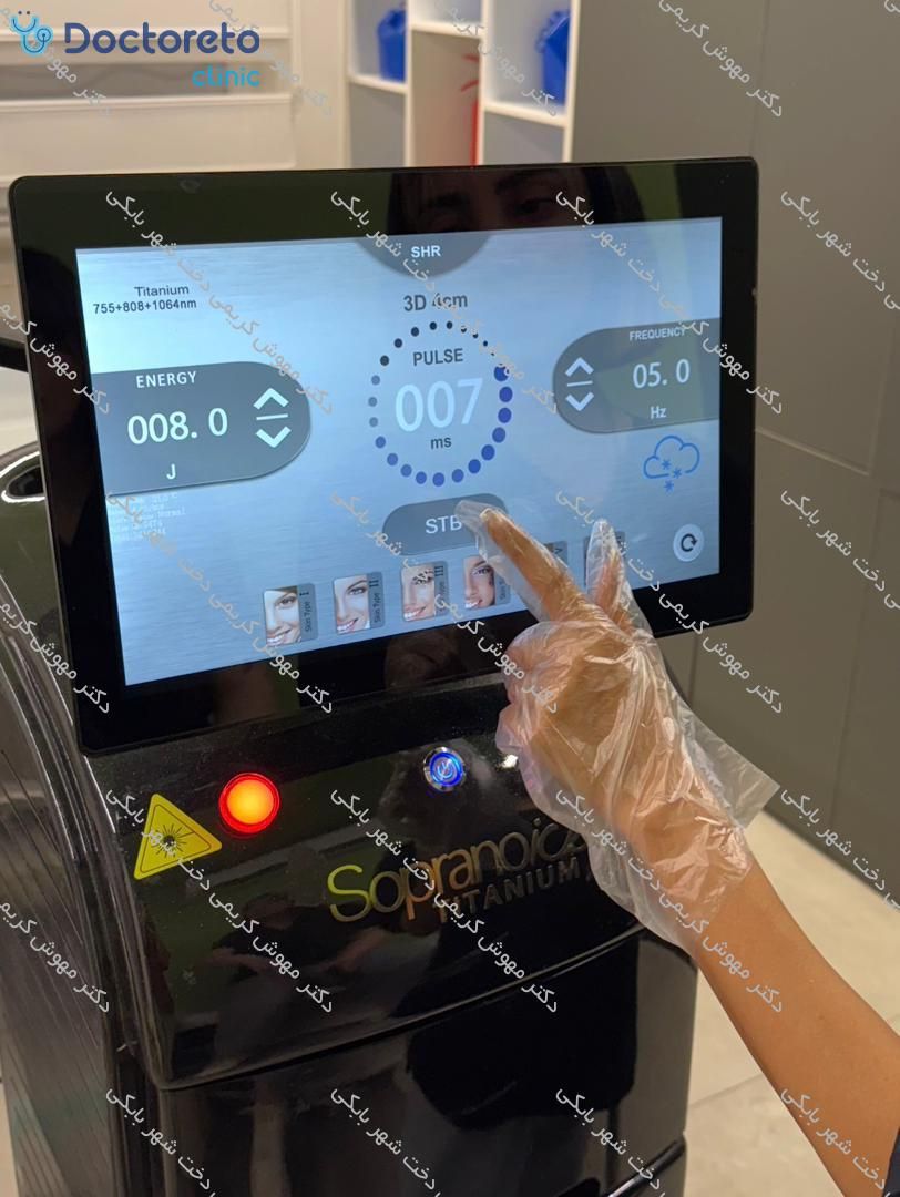 لیزر موهای زائد بانوان و آقایان با دستگاه سوپرانو آیس تیتانیوم