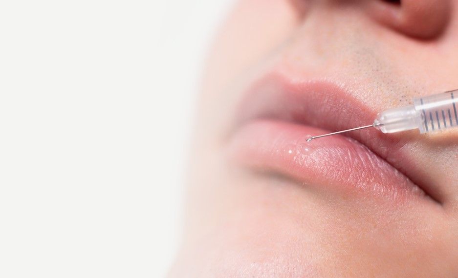 تزریق ژل لب