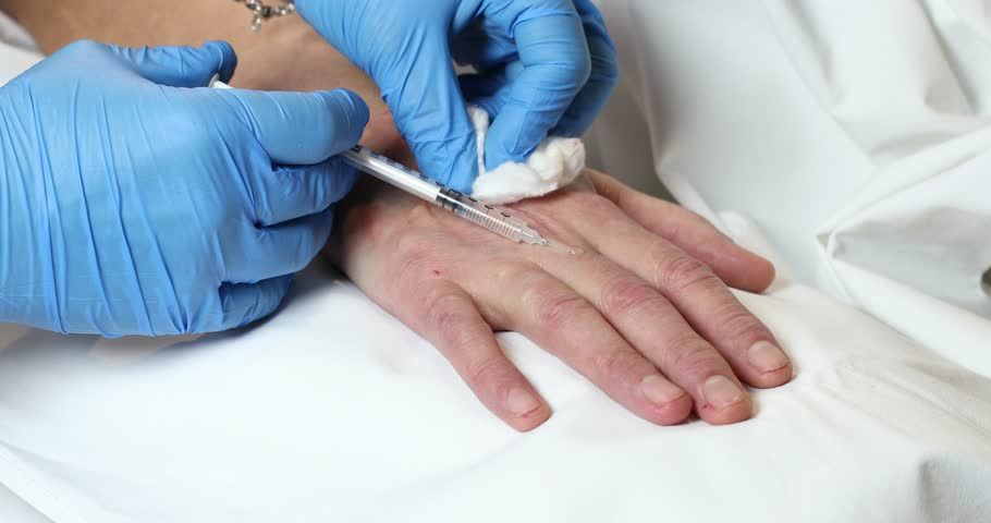 جوانسازی دست با مزوژل