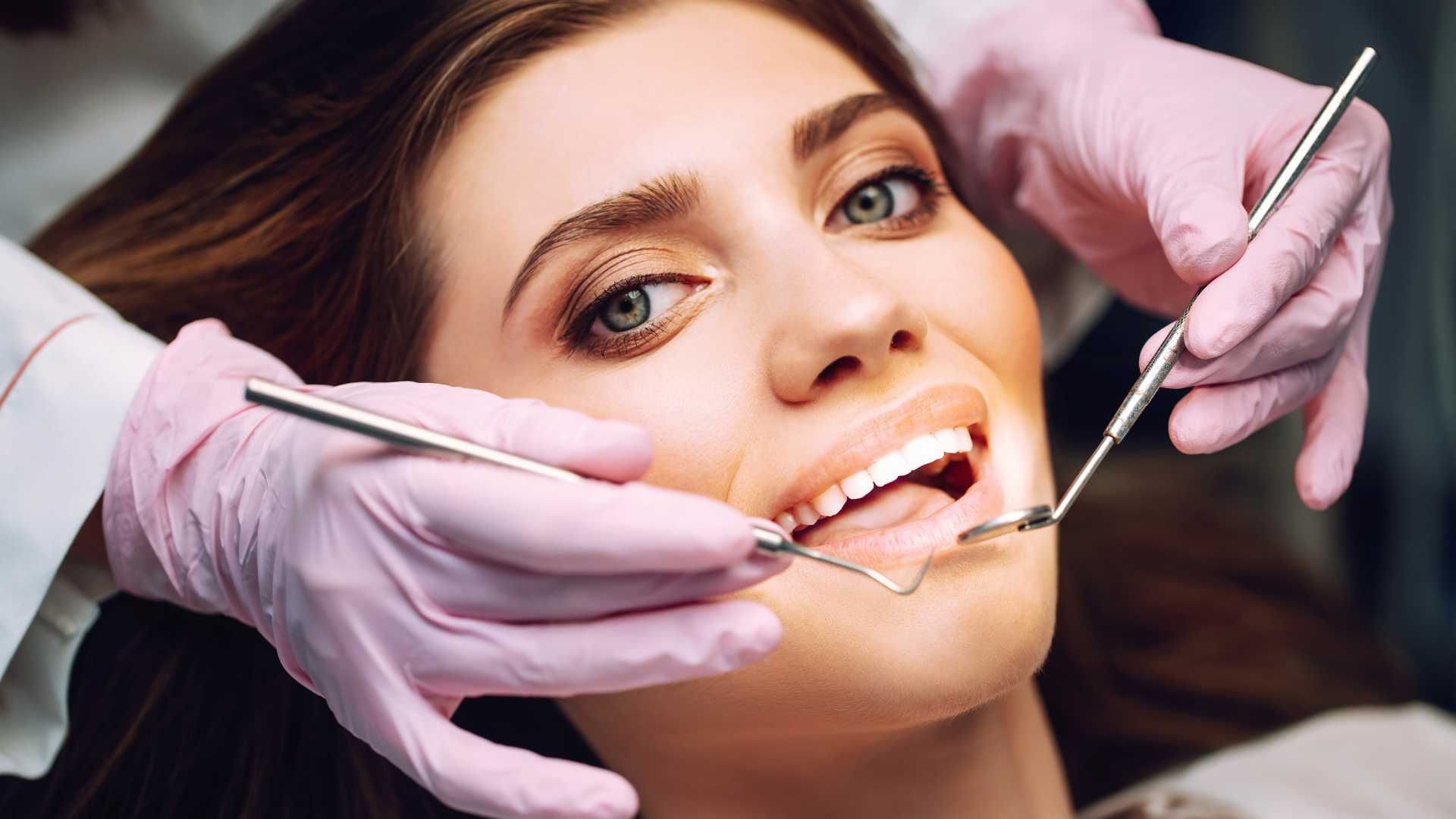 بلیچینگ دندان (سفید کردن دندان)