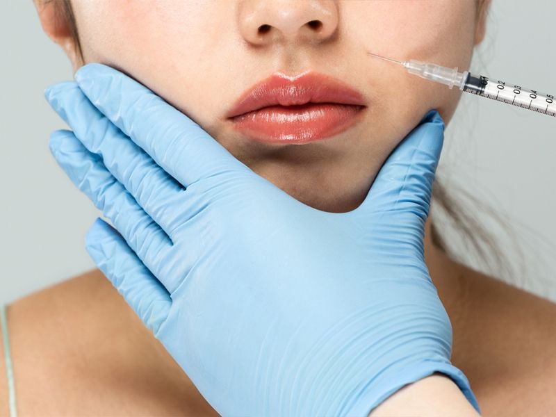 تزریق ژل خط خنده