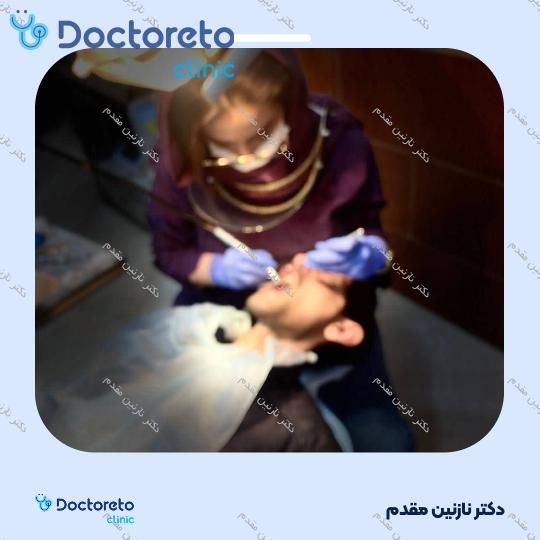 کشیدن دندان عقل (بدون جراحی) دکتر نازنین مقدم در مشهد 4
