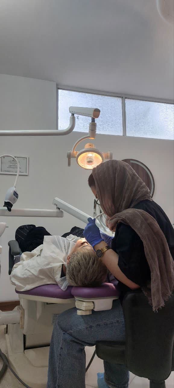 آفیس بلیچینگ دو فک با مواد آمریکایی