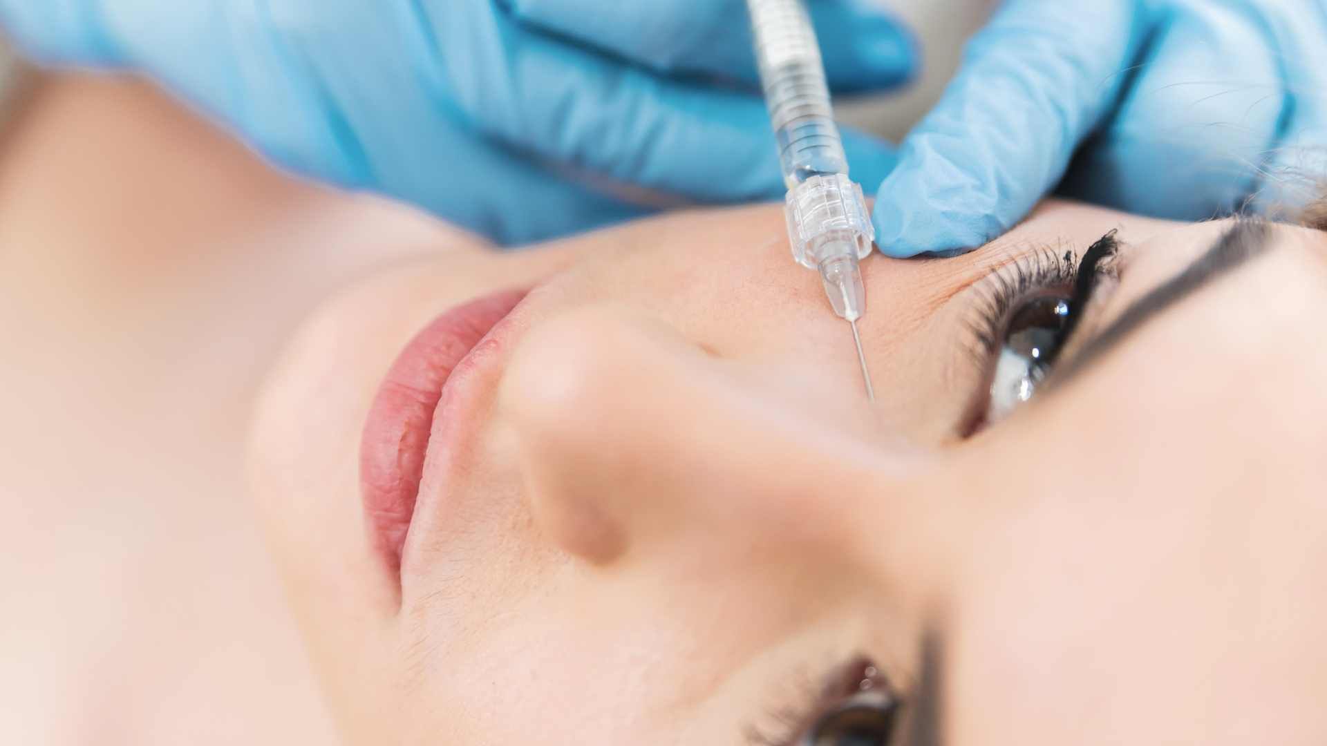 تزریق ژل زیر چشم با برند نیوویا (1cc)
