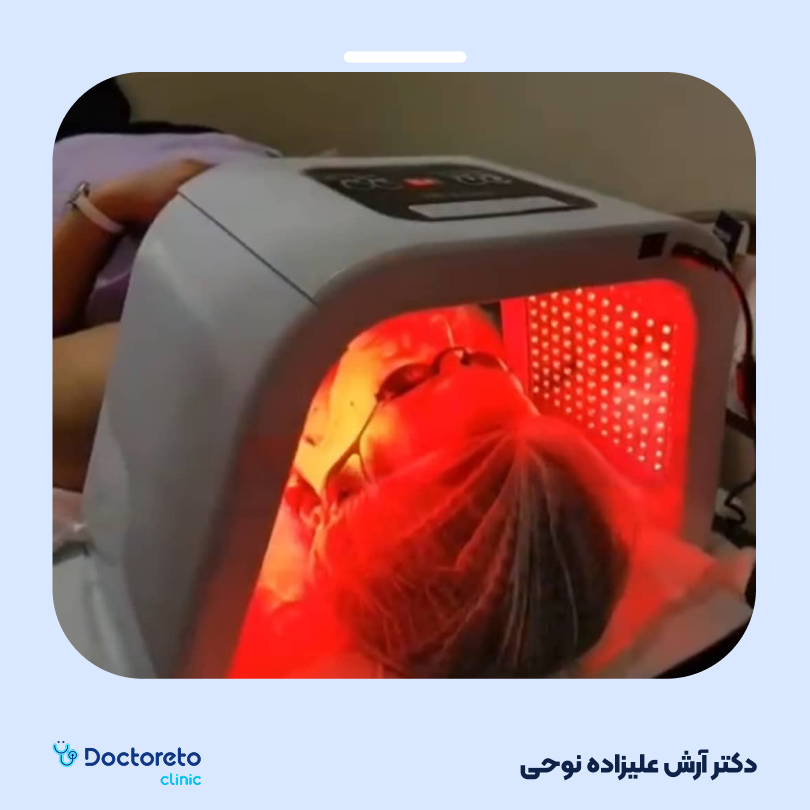 جوان سازی کل صورت با دستگاه RF دو قطبی (هر جلسه) دکتر آرش علیزاده نوحی در شاهین شهر 8