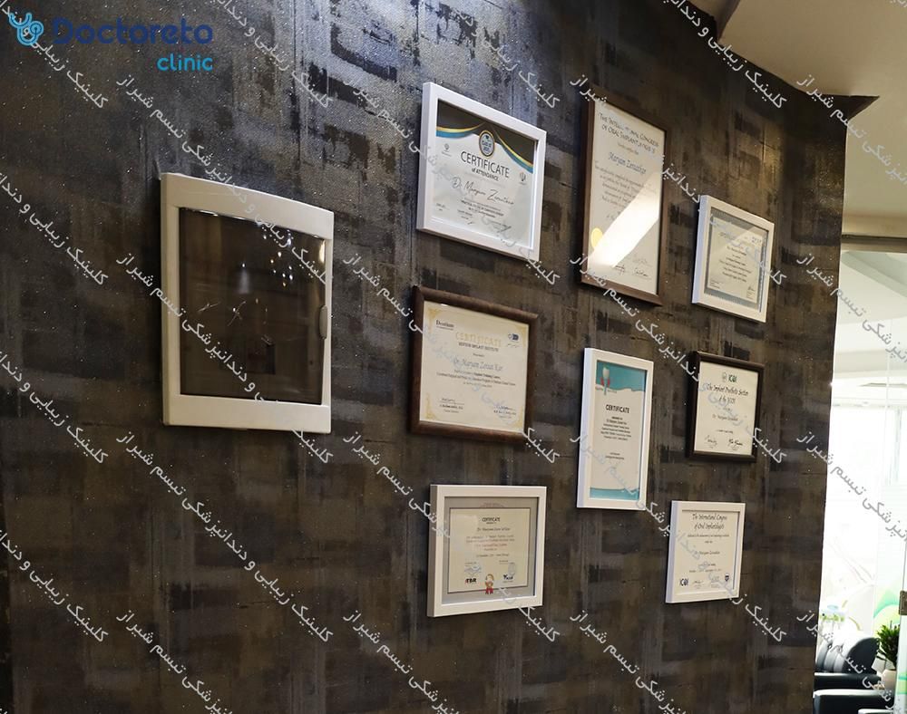 ارتودنسی نامرئی (یک فک) برای به هم ریختگی های شدید کلینیک زیبایی و دندانپزشکی تبسم شیراز در شیراز 3