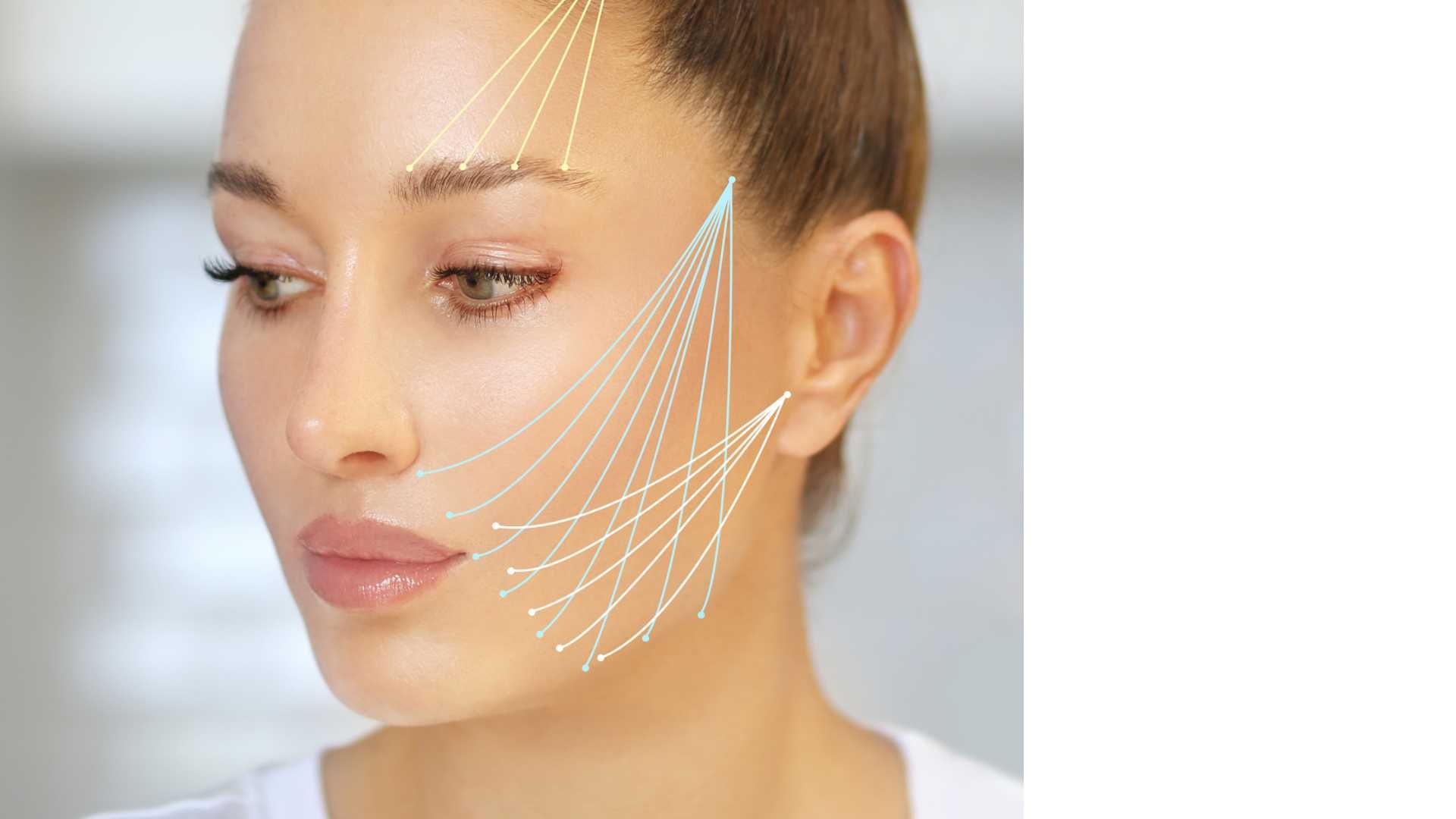 لیفت صورت با نخ مولدینگ triangle (هر نخ)