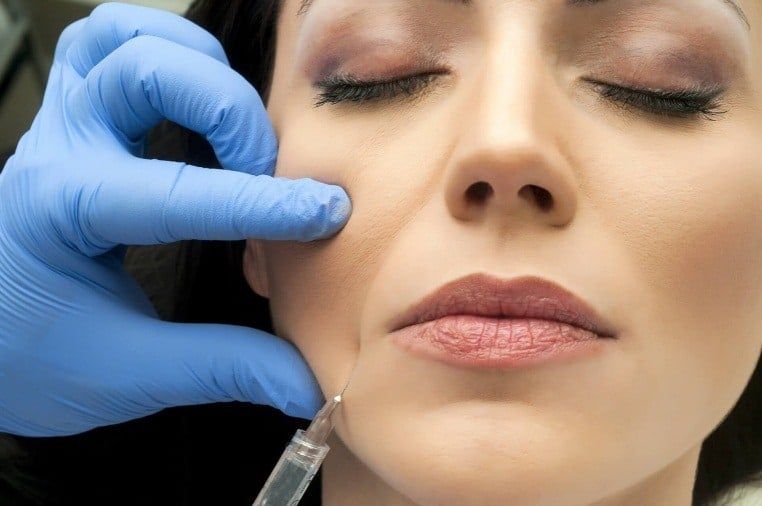 تزریق ژل خط خنده با برند رمدیوم (1cc)