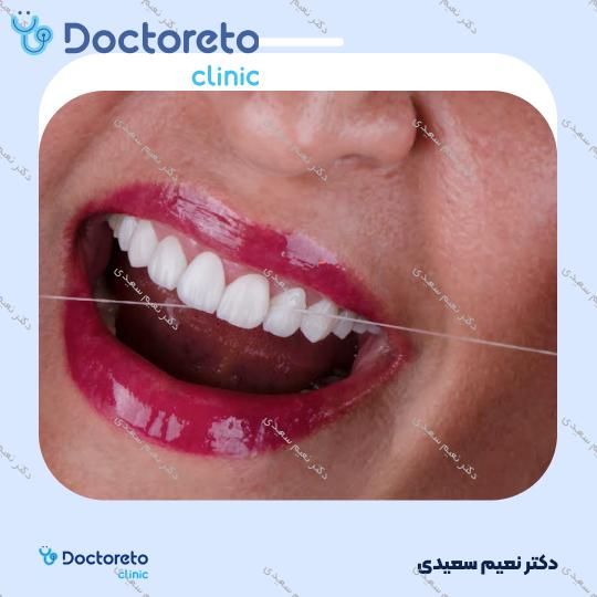 لمینت آی پی اس ایمکس (هر واحد)