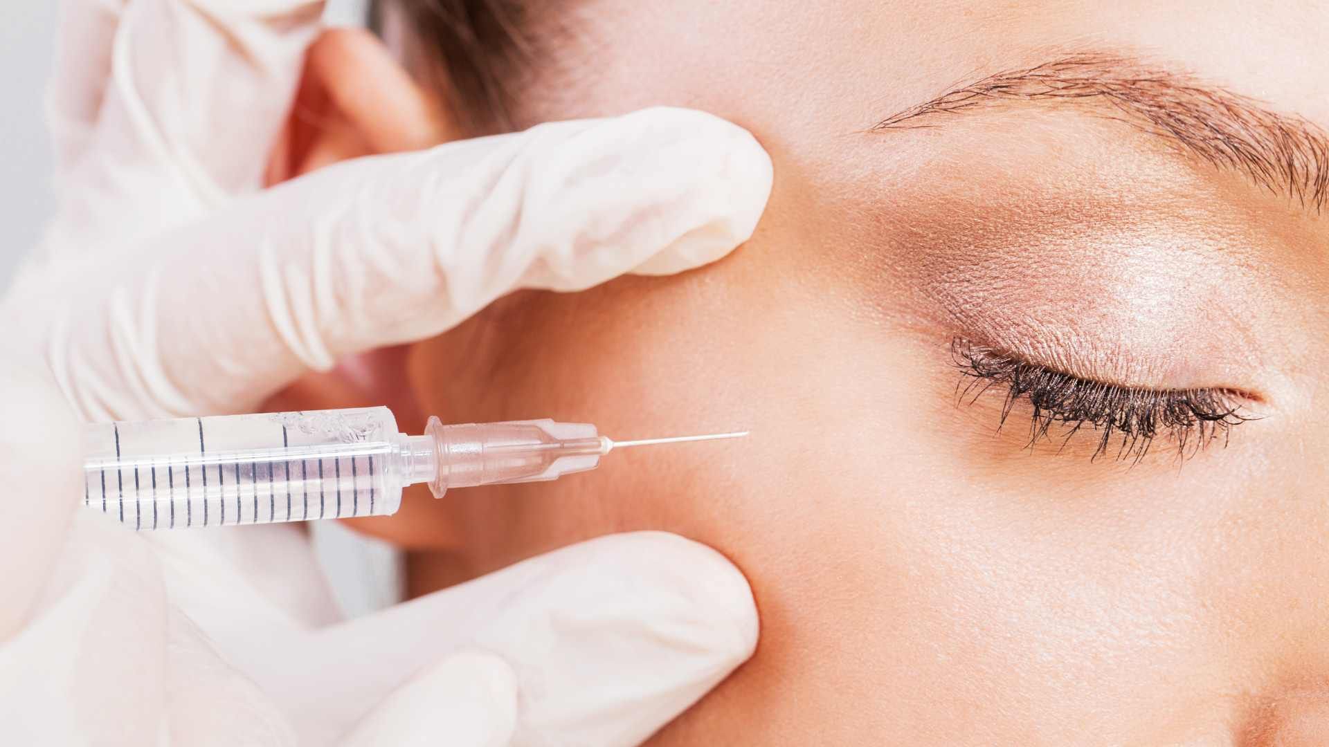 تزریق ژل زیر چشم با برند لونافیل (1cc)