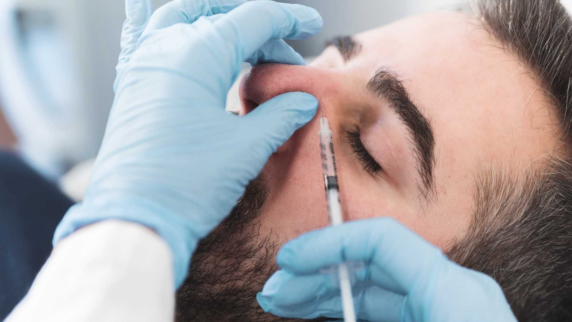 تزریق ژل بینی با برند رووفیل (1cc)