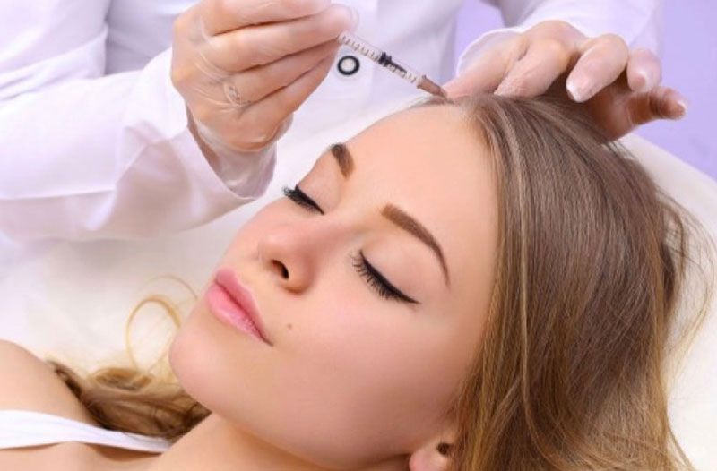مزوتراپی موی سر با برند فیوژن (هر جلسه)