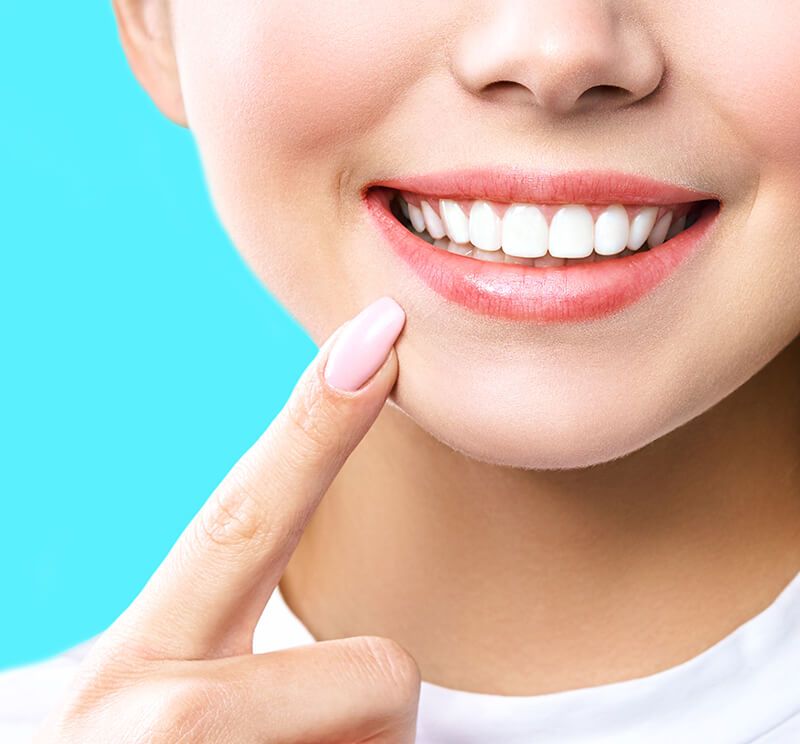 آفیس بلیچینگ (سفید کردن دندان) دو فک با مواد آمریکایی