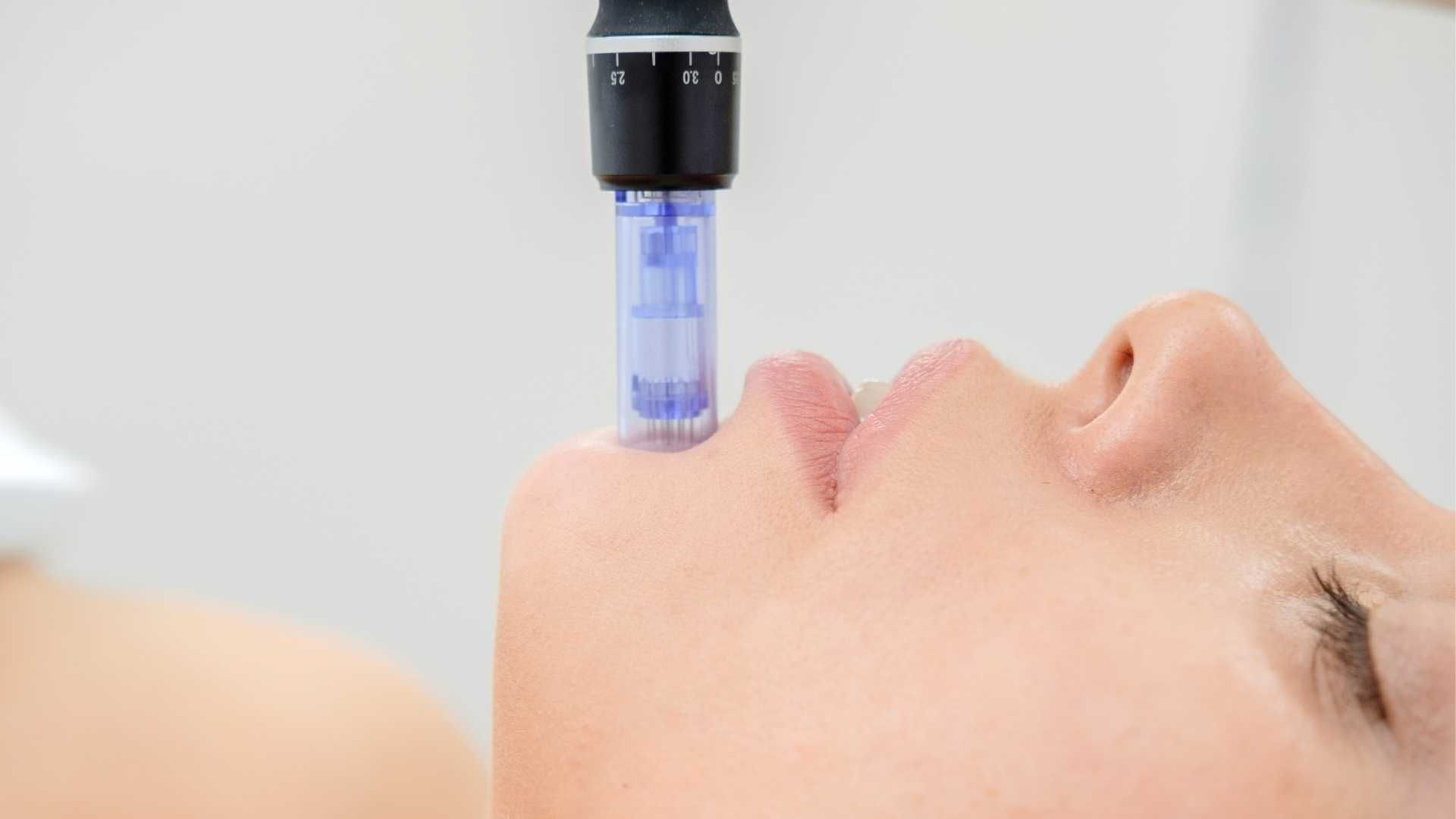 مزوتراپی با کوکتل روشن کننده رنگ چهره، سفت کننده پوست ویتامین c فیوژن (1cc)