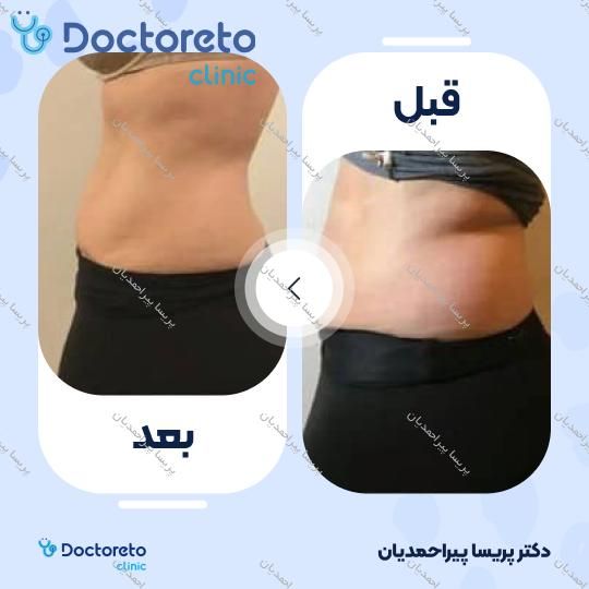 مشاوره حضوری رژیم کتوژنیک (1 جلسه ، 45 دقیقه ای) پریسا پیراحمدیان در شیراز 4
