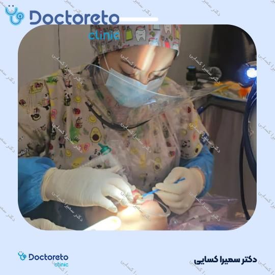 فلوراید تراپی (وارنیش) کودکان دو فک