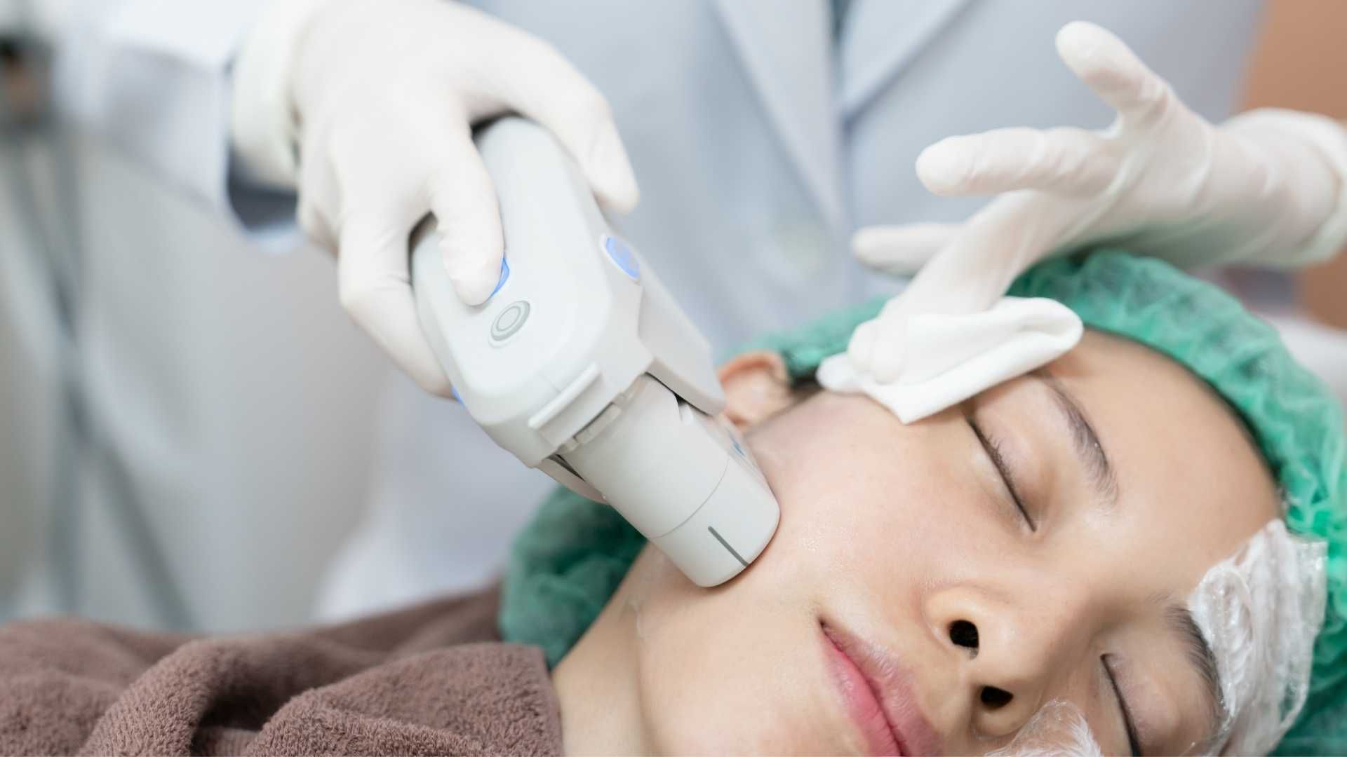 هایفوتراپی صورت با دستگاه اولترا (1جلسه)