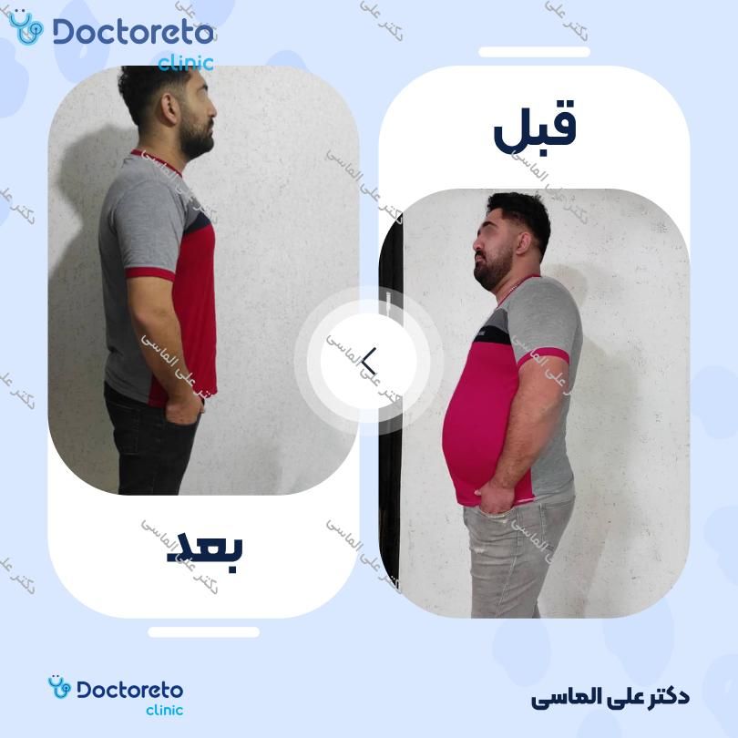 عمل جراحی پیکرتراشی