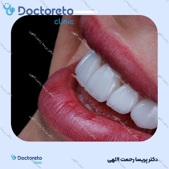جرم گیری دو فک با بروساژ زیر لثه