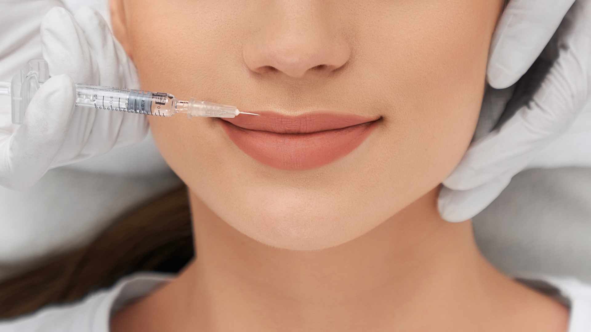 تزریق ژل لب با برند نورامیس (1cc)