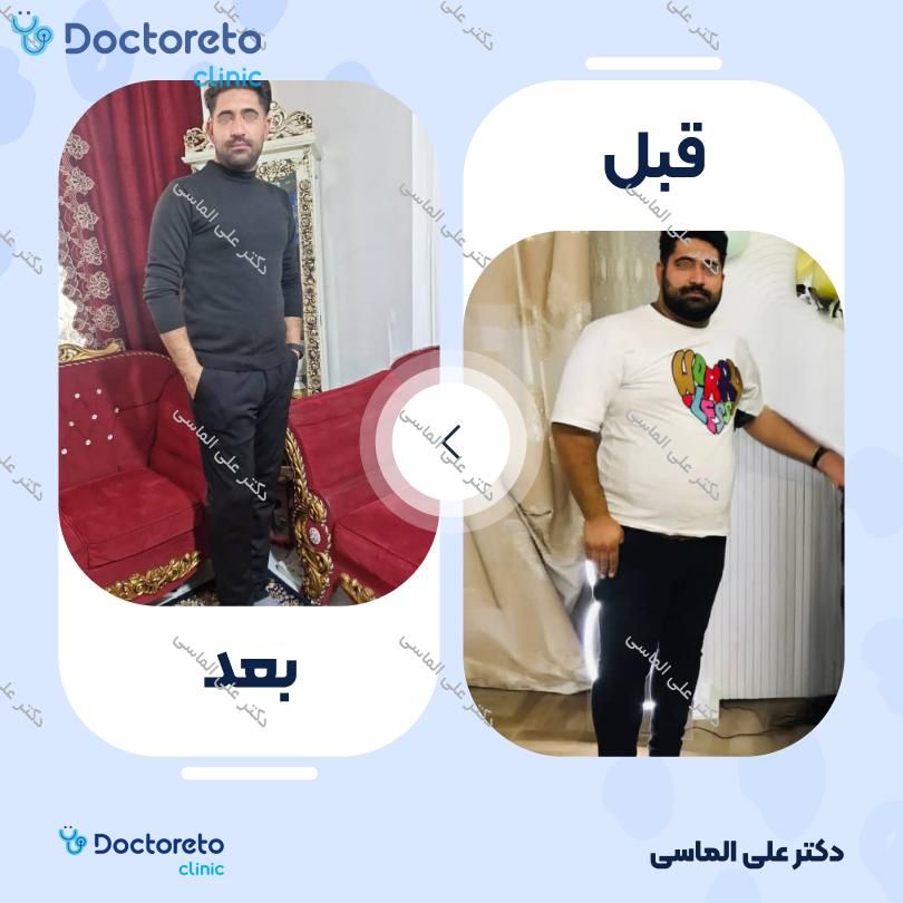 عمل جراحی پیکرتراشی