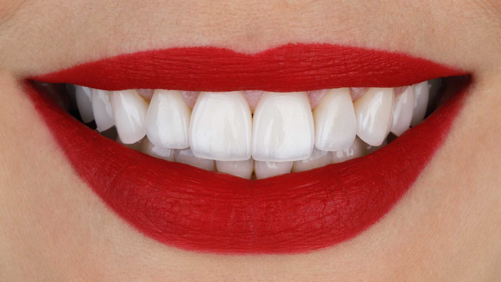 ونیر کامپوزیت توکویاما ژاپنی (هر واحد)