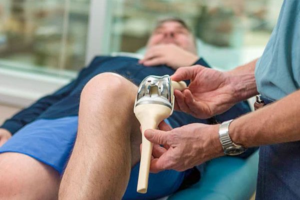 تعویض مفصل به روش جراحی