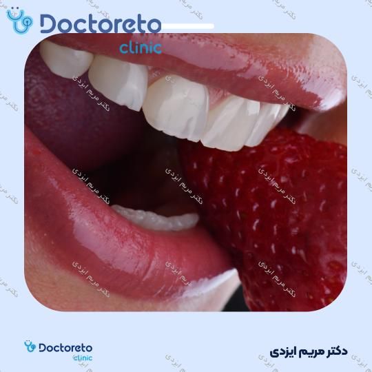 ونیر کامپوزیت توکویاما ژاپنی (هر واحد)