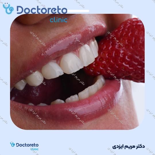 ونیر کامپوزیت توکویاما ژاپنی (هر واحد)