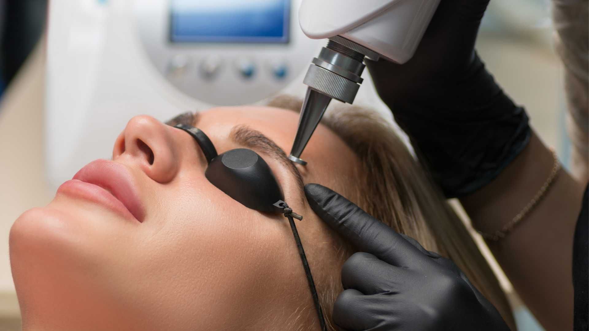پاک کردن تاتو ابرو با دستگاه کیوسوئیچ (هر جلسه)