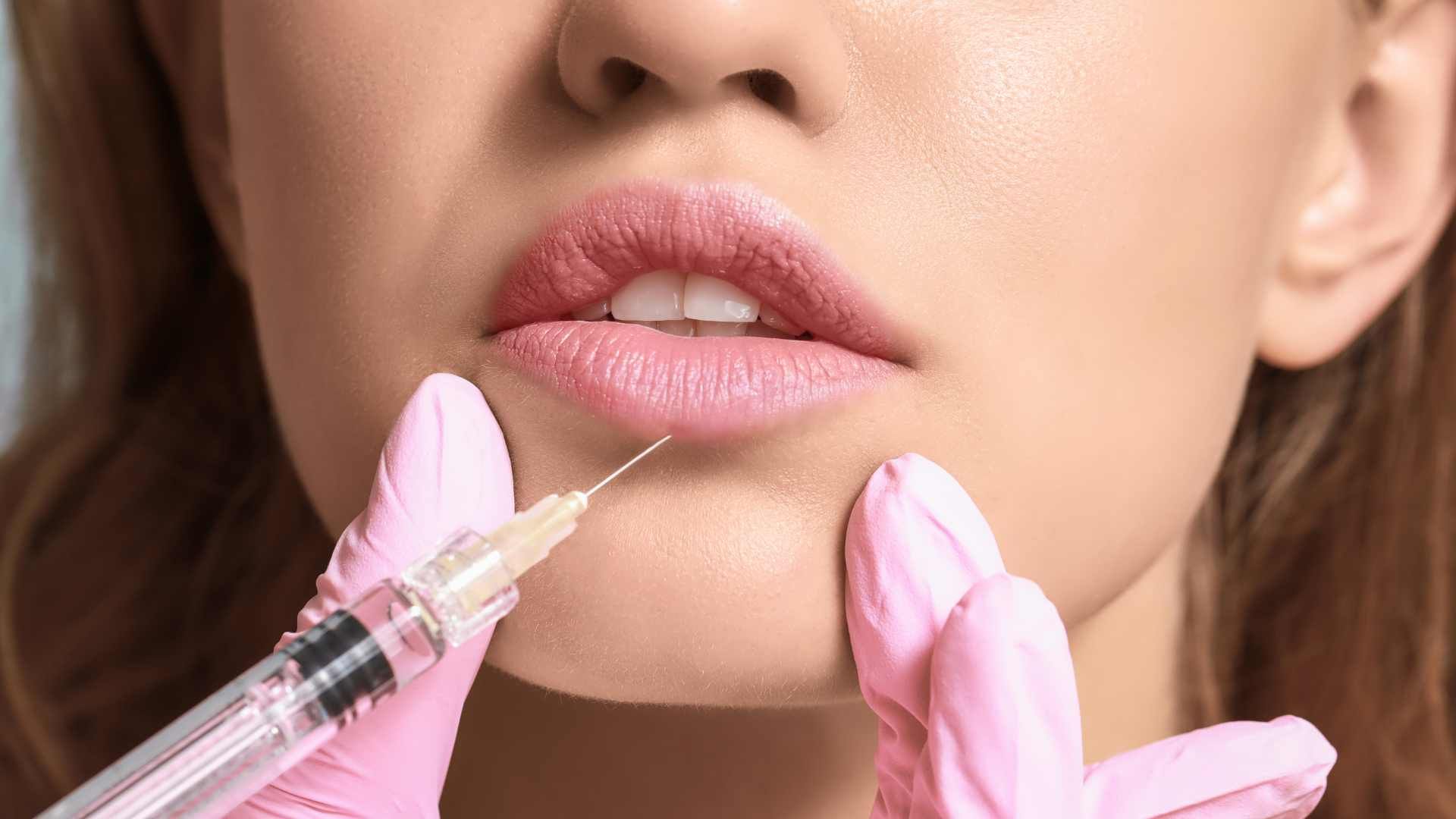تزریق ژل لب با برند اینووسنس (1cc)